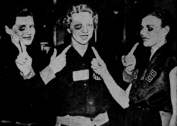 Image of three American Institute of Business basketball playing women wth black eyes following their 1936 National A.A.U. Tournament semi-final game aagainst the Eldorado Lions of Arkansas, played at Wichita, Kansas. Pictured Are Jo Langerman, Myrtle Fisher and Glennis Burket. From The Decatur Review, Decatur, Illinois, April 1, 1936.